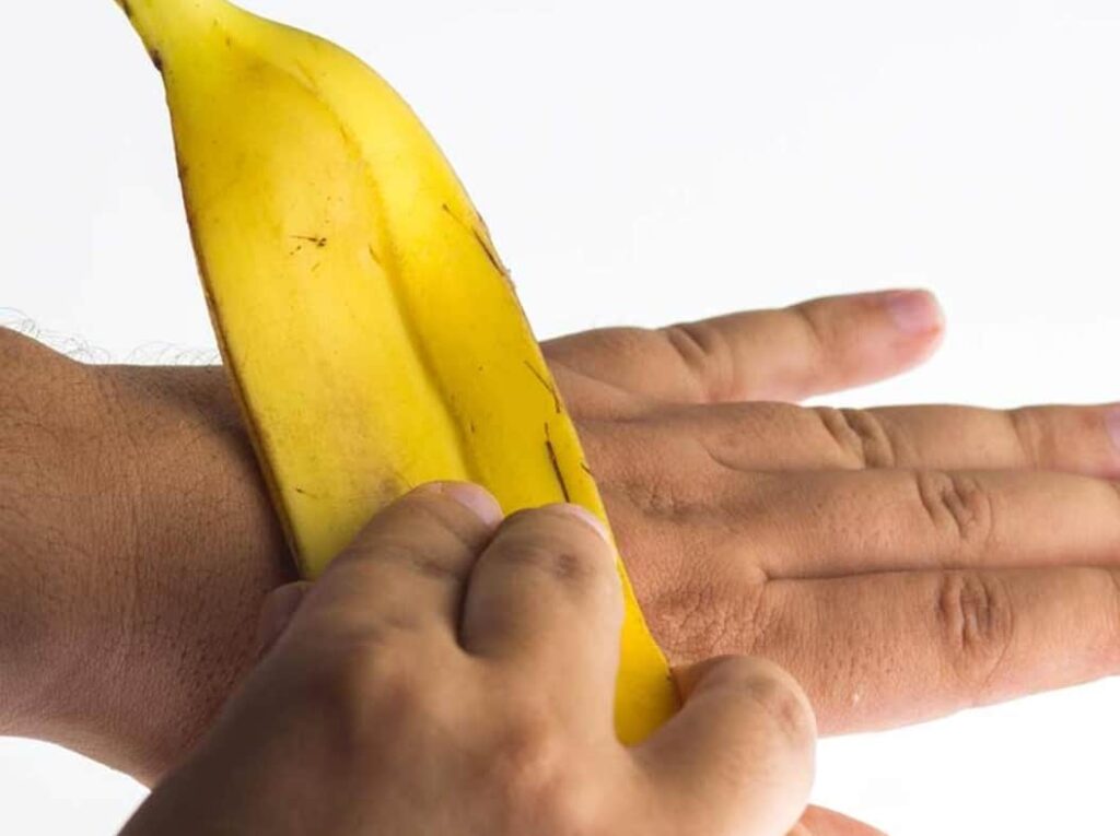 Banana Peels can help to treat Warts